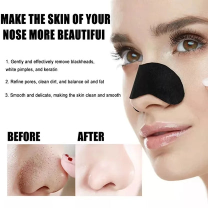 Facial Blackhead Removal Stickers