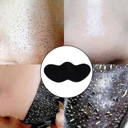 Facial Blackhead Removal Stickers